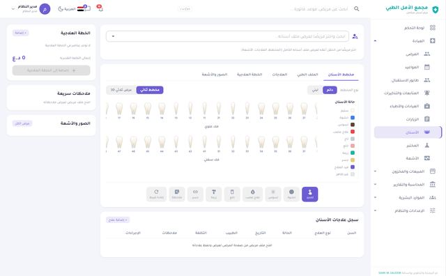 عيادة الأسنان — مخطط الأسنان